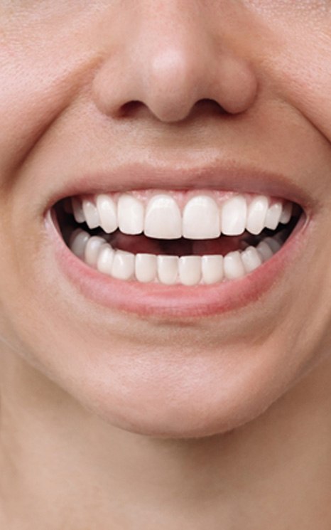 Close up of a smile before and after cosmetic dentistry treatment