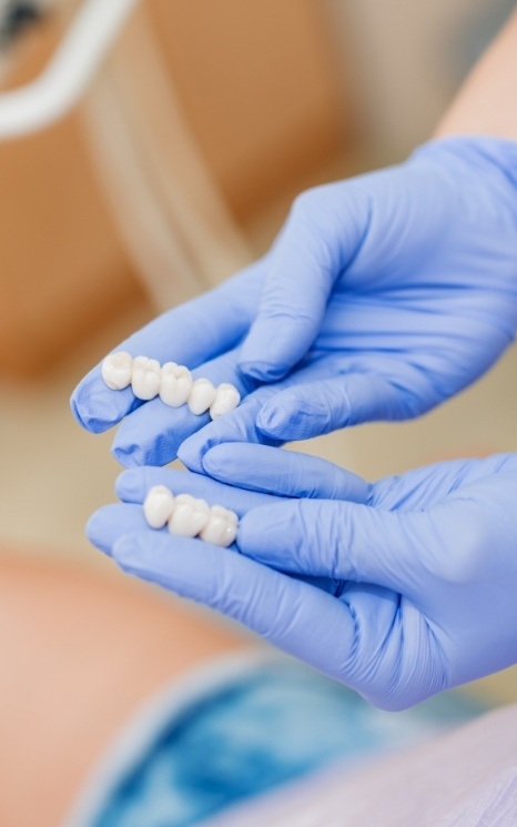 Dentist holding two types of dental bridges