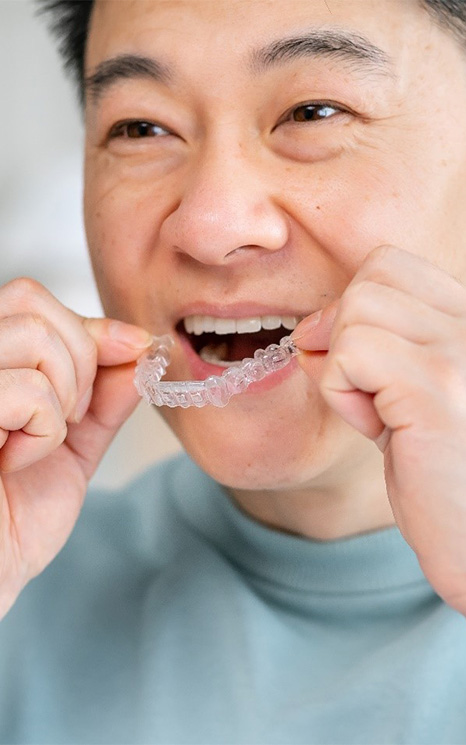 Man placing a Candid Pro Clear Aligner over his upper teeth