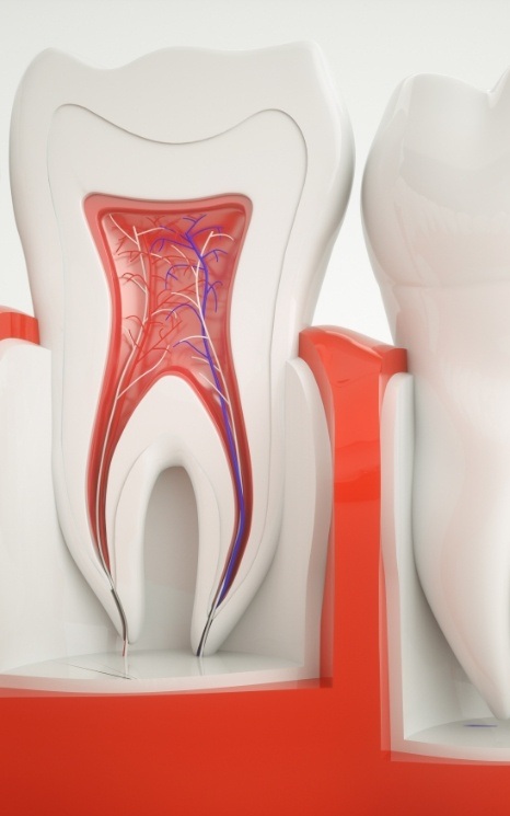 Animated inside of a tooth used to explain root canal therapy