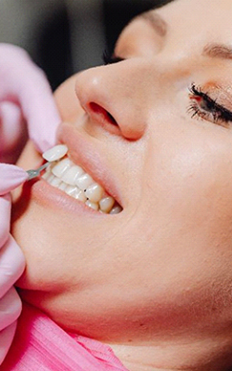 Woman at dentist for veneers