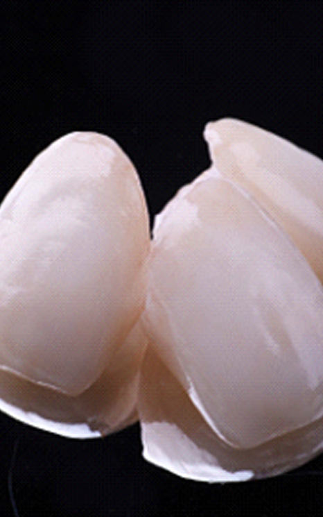 Close up of several veneers