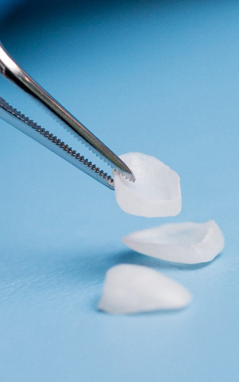 Close up of a pair of tweezers picking up a veneer