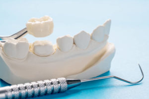 Model of dental crown and oral instruments