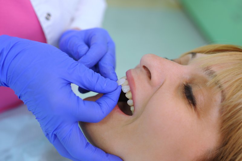 A woman getting her dental veneer replaced